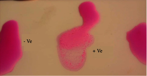 The Effect of Erythritol Injection in Decreasing of Abortion Rate in Local Breed Ewes.