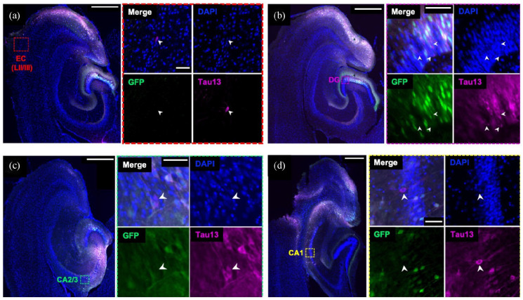 Apolipoprotein E isoform does not influence trans-synaptic spread of tau pathology in a mouse model.