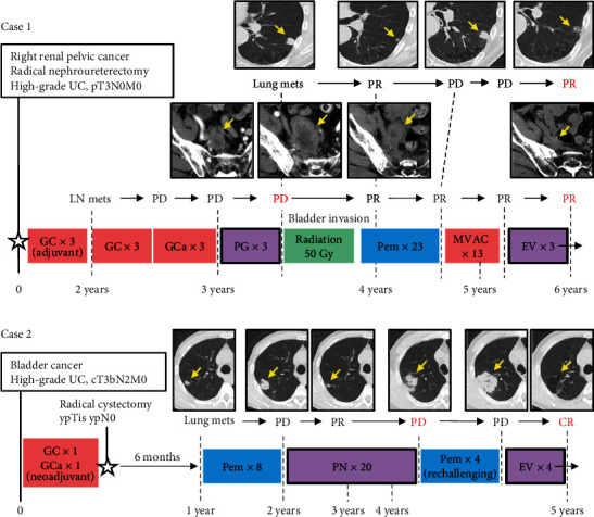 Response of Patients with Taxane-Refractory Advanced Urothelial Cancer to Enfortumab Vedotin, a Microtubule-Disrupting Agent.