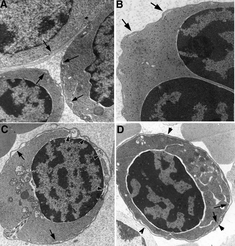 Ultrastructural characteristics of erythroid cells in congenital dyserythropoietic anemia type II, with a focus on peripheral cisternae and double membranes.