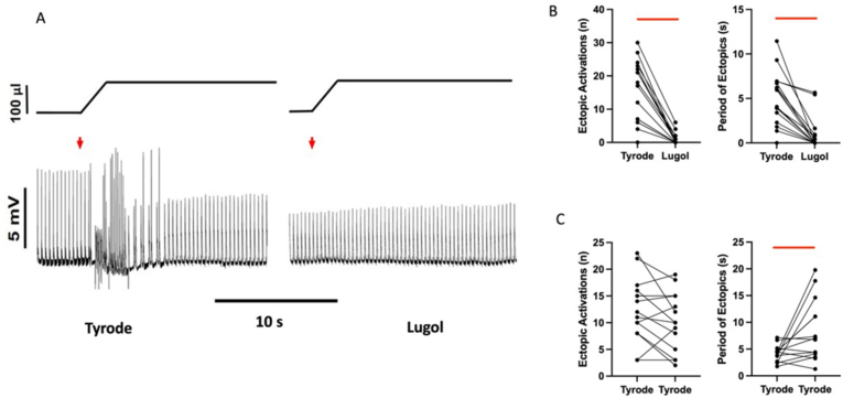 Endocardial role in arrhythmias induced by acute ventricular stretch and the involvement of Purkinje fibres, in isolated rat hearts