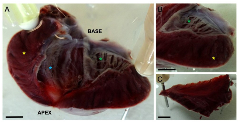 Endocardial role in arrhythmias induced by acute ventricular stretch and the involvement of Purkinje fibres, in isolated rat hearts