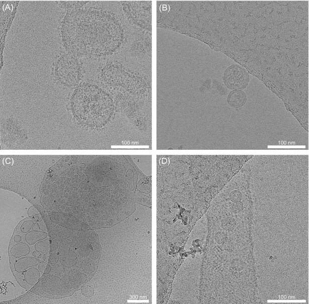 Characterization of membrane vesicles in <i>Alteromonas macleodii</i> indicates potential roles in their copiotrophic lifestyle.