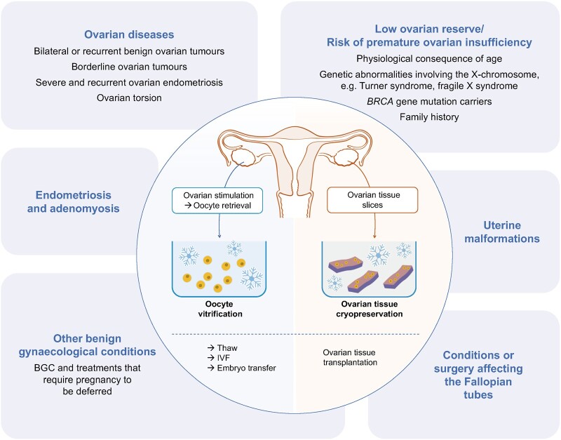 Fertility preservation in women with benign gynaecological conditions.