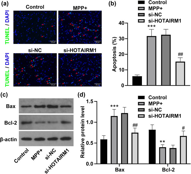 HOTAIRM1 knockdown reduces MPP<sup>+</sup>-induced oxidative stress injury of SH-SY5Y cells by activating the Nrf2/HO-1 pathway.