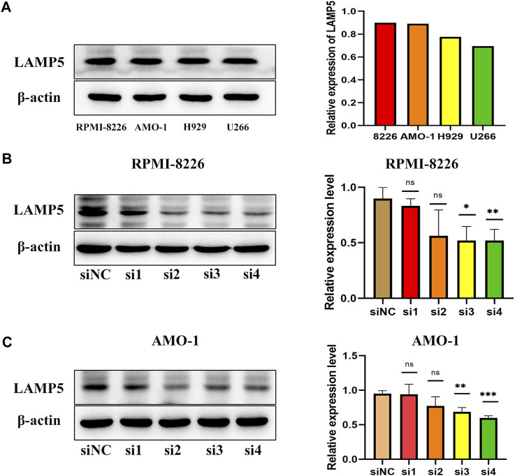 LAMP5 may promote MM progression by activating p38.