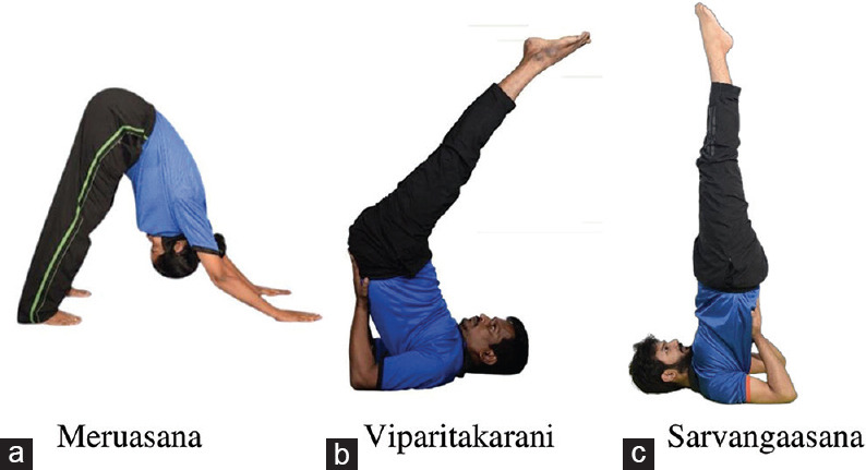 Intraocular Pressure Changes Following Three "Head below the Heart" Postures in Yoga Practitioners - A Prospective Observational Study.