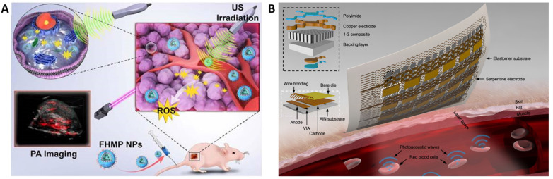 Current Trends in Nanotheranostics: A Concise Review on Bioimaging and Smart Wearable Technology.