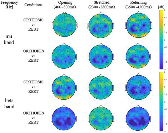 Cortical processing during robot and functional electrical stimulation.