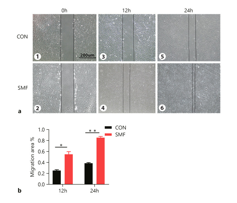 Static Magnetic Field Promotes Proliferation, Migration, Differentiation, and AKT Activation of Periodontal Ligament Stem Cells.