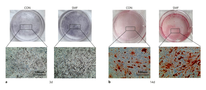 Static Magnetic Field Promotes Proliferation, Migration, Differentiation, and AKT Activation of Periodontal Ligament Stem Cells.