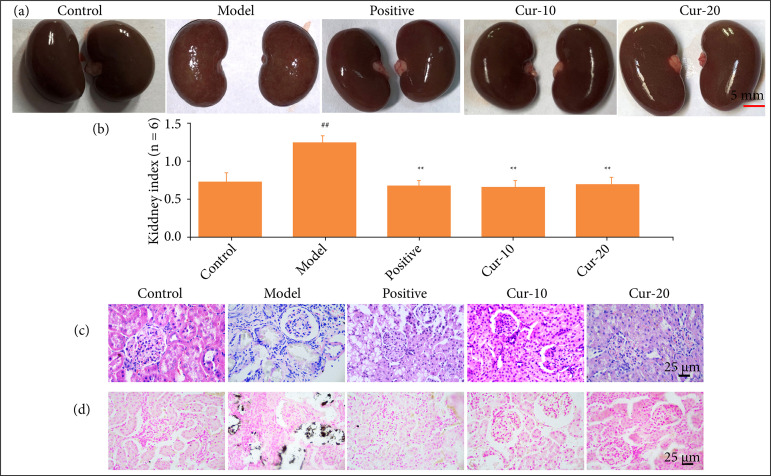 Curcumin alleviated oxidation stress injury by mediating osteopontin in nephrolithiasis rats.