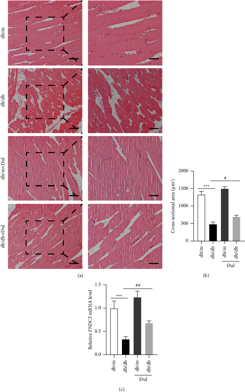 Dulaglutide Protects Mice against Diabetic Sarcopenia-Mediated Muscle Injury by Inhibiting Inflammation and Regulating the Differentiation of Myoblasts.