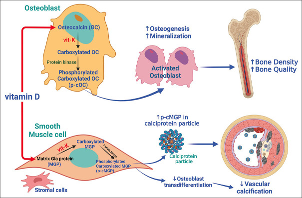 Editorial comment on Vitamin K and vascular calcification in chronic kidney disease: An update of current evidence - The role of Vitamin K in managing chronic kidney disease-mineral bone disorder.