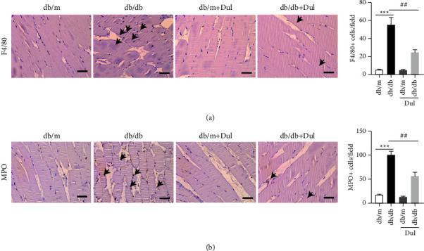 Dulaglutide Protects Mice against Diabetic Sarcopenia-Mediated Muscle Injury by Inhibiting Inflammation and Regulating the Differentiation of Myoblasts.