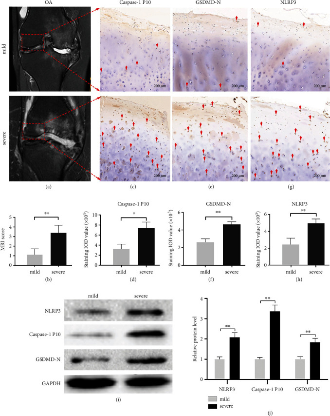 PPAR-<i>γ</i> Activation Alleviates Osteoarthritis through Both the Nrf2/NLRP3 and PGC-1<i>α</i>/<i>Δψ</i> <sub>m</sub> Pathways by Inhibiting Pyroptosis.