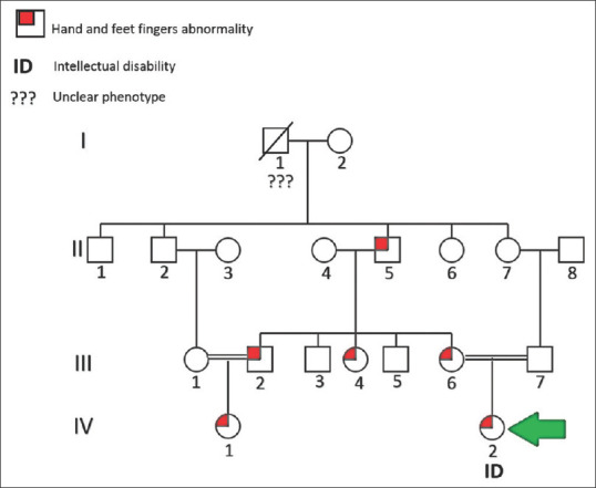 A Novel Missense Mutation in the TGF-β-binding Protein-Like Domain 3 of <i>FBN1</i> Causes Weill-Marchesani Syndrome with Intellectual Disability.