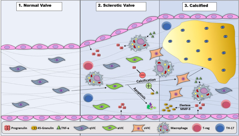 Progranulin (PGRN) as a regulator of inflammation and a critical factor in the immunopathogenesis of cardiovascular diseases.