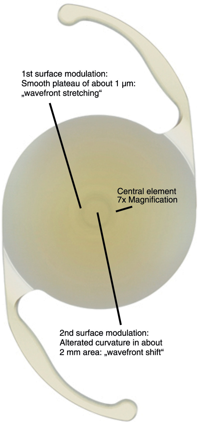 Enhanced Depth of Focus Intraocular Lenses: Through Focus Evaluation of Wavefront-Shaping versus Diffractive Optics.