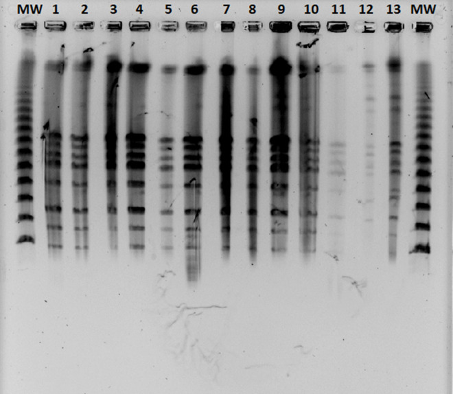 Leptospirosis and characterization of <i>Leptospira</i> isolates from patients in Koprivnica-Križevci County, Croatia from 2000-2004.