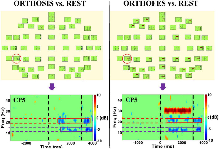 Cortical processing during robot and functional electrical stimulation.