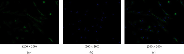 Effects of Fibulin-5 Gene Silencing on Proliferation and Apoptosis of IgG4-ROD Lacrimal Gland Fibroblasts.