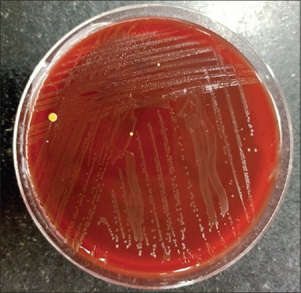 <i>Erysipelothrix</i> Bacteremia; is Endocarditis a Rule?