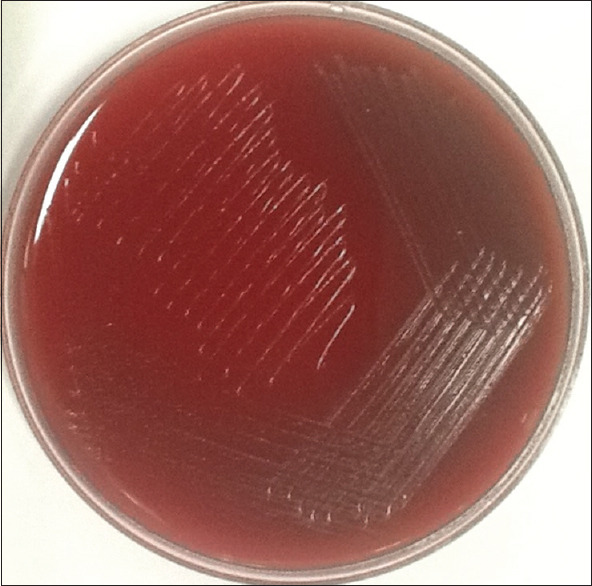 <i>Erysipelothrix</i> Bacteremia; is Endocarditis a Rule?