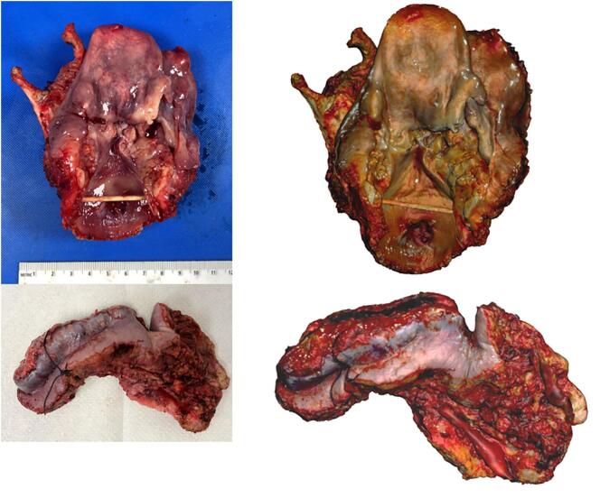 Ex vivo 3D scanning and specimen mapping in anatomic pathology