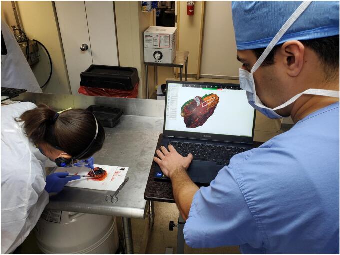 Ex vivo 3D scanning and specimen mapping in anatomic pathology