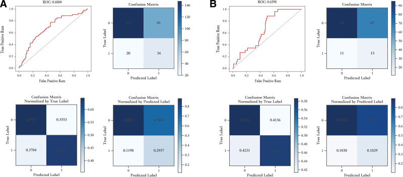 Machine learning algorithm as a prognostic tool for Epstein-Barr virus reactivation after haploidentical hematopoietic stem cell transplantation.