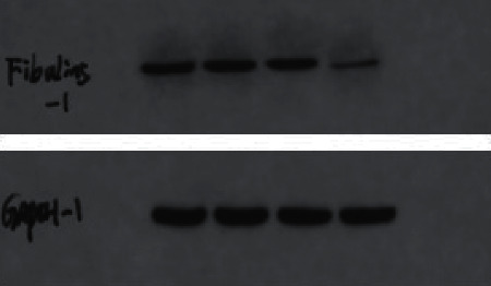 Effects of Fibulin-5 Gene Silencing on Proliferation and Apoptosis of IgG4-ROD Lacrimal Gland Fibroblasts.