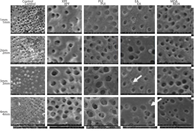 Evaluation of Different Agitation Techniques on Smear Layer Formation and Dentine Erosions- An In Vitro Study.