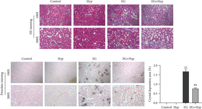 Hyperoside Ameliorates Renal Tubular Oxidative Damage and Calcium Oxalate Deposition in Rats through AMPK/Nrf2 Signaling Axis.