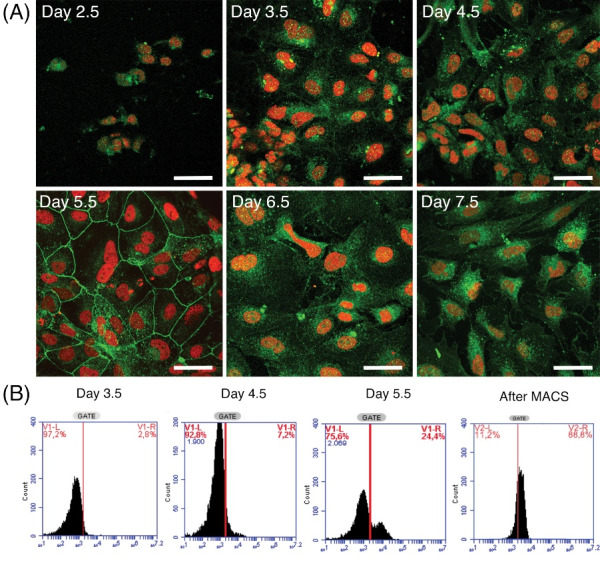 Differentiation and molecular characterization of endothelial progenitor and vascular smooth muscle cells from induced pluripotent stem cells.