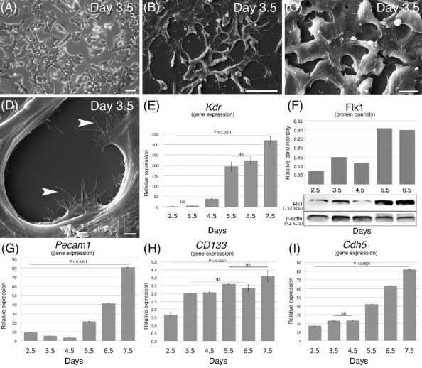 Differentiation and molecular characterization of endothelial progenitor and vascular smooth muscle cells from induced pluripotent stem cells.