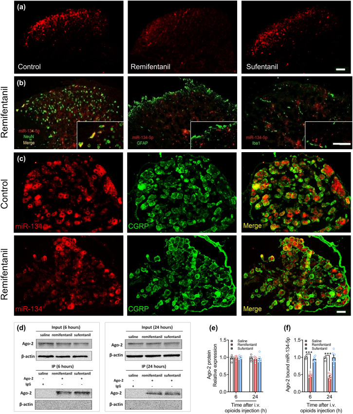 Spinal microRNA-134-5p targets glutamate receptor ionotropic kainate 3 to modulate opioid induced hyperalgesia in mice.