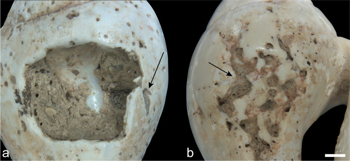 The Ornaments of the Arma Veirana Early Mesolithic Infant Burial.