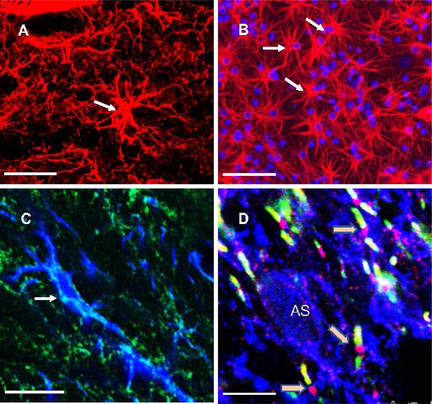 Astrocytes as Context for the Involvement of Myelin and Nodes of Ranvier in the Pathophysiology of Depression and Stress-Related Disorders.