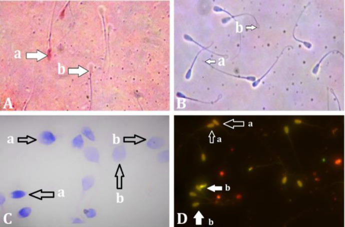 Comparison of sperm characteristics and antioxidant and oxidant levels in bull semen frozen with four widely used extenders.