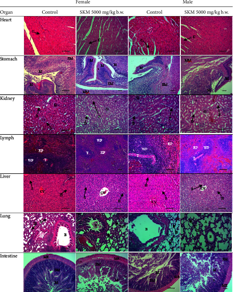 Acute and Subchronic Oral Toxicity Evaluation of Herbal Formulation: <i>Piper crocatum</i> Ruiz and Pav., <i>Typhonium flagelliforme</i> (Lodd.) Blume, and <i>Phyllanthus niruri</i> L. in Sprague-Dawley Rats.