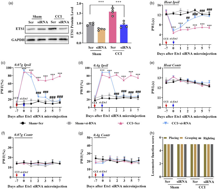 Transcription factor ETS proto-oncogene 1 contributes to neuropathic pain by regulating histone deacetylase 1 in primary afferent neurons.