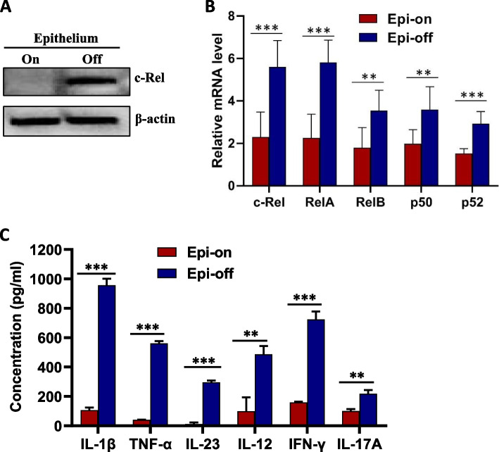 Accelerating corneal wound healing using exosome-mediated targeting of NF-κB c-Rel.