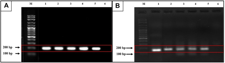 <i>RET</i> rearrangements are relevant to histopathologic subtypes and clinicopathological features in Thai papillary thyroid carcinoma patients.