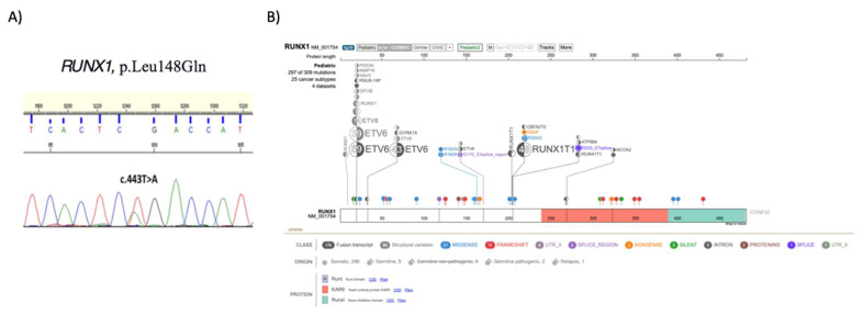 Novel <i>RUNX1</i> Variation in B-cell Acute Lymphoblastic Leukemia.