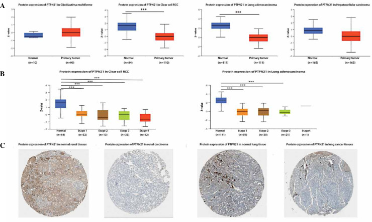 Prognostic value and immunological role of PTPN21 in pan-cancer analysis.