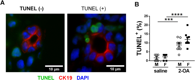 Apoptotic biliary epithelial cells and gut dysbiosis in the induction of murine primary biliary cholangitis