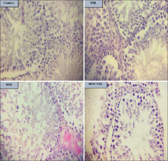 Effect of troxerutin on the expression of genes regulating mitochondrial biogenesis and microRNA-140 in doxorubicin-induced testicular toxicity.