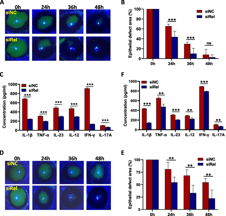 Accelerating corneal wound healing using exosome-mediated targeting of NF-κB c-Rel.