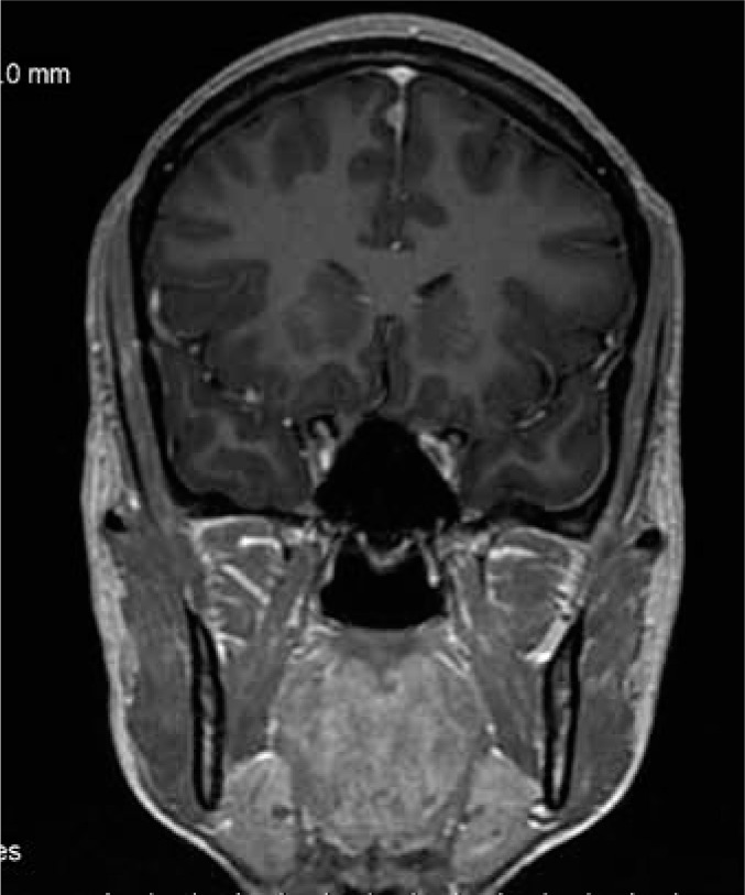 Opinion on "The role of radiologist in the changing world of healthcare: a White Paper of the European Society of Radiology (ESR)".